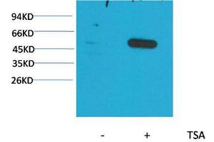 Western Blot (WB) analysis of extracts from HeLa cells, untreated (-) or treated with TSA (1muM, 18 hr+), using Acetyl- a-tubulin(Lys40) Mouse Monoclonal Antibody 1:2000. (alpha Tubulin Antikörper  (acLys40))