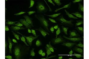 Immunofluorescence of monoclonal antibody to EIF4EBP3 on HeLa cell. (EIF4EBP3 Antikörper  (AA 1-100))