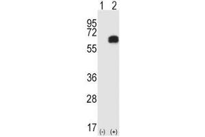 Western blot analysis of RIPK2 antibody and 293 cell lysate either nontransfected (Lane 1) or transiently transfected (2) with the RIPK2 gene. (RIPK2 Antikörper  (AA 458-488))