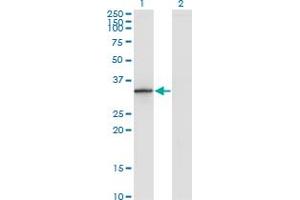 Western Blot analysis of DHRS9 expression in transfected 293T cell line by DHRS9 monoclonal antibody (M06), clone 3E3.