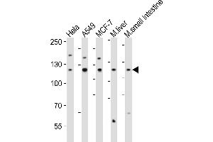 Western blot analysis of lysates from Hela, A549, MCF-7 cell line, mouse liver, mouse small intestine tissue lysate(from left to right), using ZN Antibody (Center) (ABIN6242706 and ABIN6577885). (ZNF281 Antikörper  (AA 416-450))