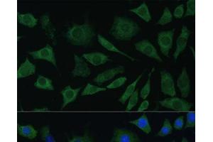 Immunofluorescence analysis of L929 cells using BMPR1B Polyclonal Antibody at dilution of 1:100. (BMPR1B Antikörper)