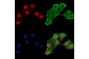 ABIN7093411 and ABIN7097434 staining Hela cells by IF/ICC.