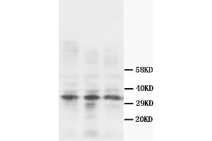Western Blotting (WB) image for anti-Calponin 1 (CNN1) antibody (ABIN1105641) (CNN1 Antikörper)
