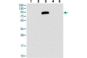 Western blot analysis of Lane 1: RT-4, Lane 2: U-251 MG, Lane 3: Human Plasma, Lane 4: Liver, Lane 5: Tonsil with IGFALS polyclonal antibody  at 1:250-1:500 dilution.