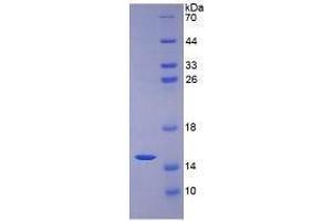 SDS-PAGE analysis of Human Mucin 2 Protein. (MUC2 Protein)