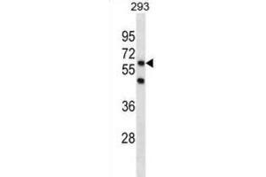 Western Blotting (WB) image for anti-PiggyBac Transposable Element Derived 3 (PGBD3) antibody (ABIN3001306) (PGBD3 Antikörper)