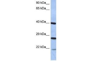 Western Blot showing CIDEB antibody used at a concentration of 1-2 ug/ml to detect its target protein. (CIDEB Antikörper  (Middle Region))