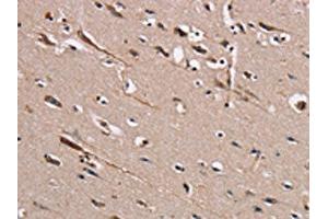 Immunohistochemistry (IHC) image for anti-TRAF-Type Zinc Finger Domain Containing 1 (TRAFD1) antibody (ABIN7131459)