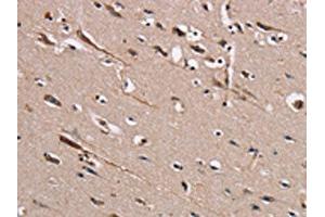 The image on the left is immunohistochemistry of paraffin-embedded Human brain tissue using ABIN7131459(TRAFD1 Antibody) at dilution 1/20, on the right is treated with fusion protein. (TRAFD1 Antikörper)
