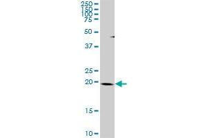 THAP1 MaxPab rabbit polyclonal antibody. (THAP1 Antikörper  (AA 1-213))