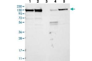 Western blot analysis of Lane 1: RT-4, Lane 2: U-251 MG, Lane 3: Human Plasma, Lane 4: Liver, Lane 5: Tonsil with MATR3 polyclonal antibody  at 1:250-1:500 dilution. (MATR3 Antikörper)