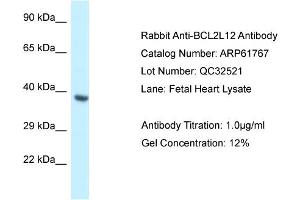 Western Blotting (WB) image for anti-BCL2-Like 12 (Proline Rich) (BCL2L12) (Middle Region) antibody (ABIN2788895)