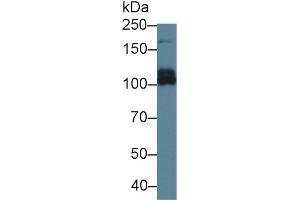 Detection of ABCC6 in Rat Liver lysate using Polyclonal Antibody to ATP Binding Cassette Transporter C6 (ABCC6) (ABCC6 Antikörper  (AA 1260-1502))