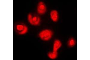 Immunofluorescent analysis of DUSP16 staining in COLO205 cells.