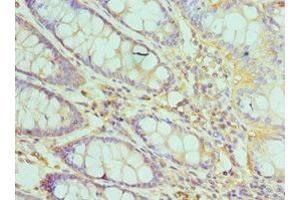 Immunohistochemistry of paraffin-embedded human colon tissue using ABIN7172503 at dilution of 1:100 (DP1 Antikörper  (AA 1-290))