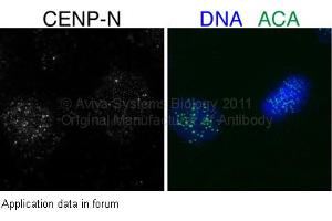 Image no. 1 for anti-Centromere Protein N (CENPN) (Middle Region) antibody (ABIN2787136) (CENPN Antikörper  (Middle Region))