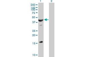 Western Blot analysis of ASB6 expression in transfected 293T cell line by ASB6 MaxPab polyclonal antibody. (ASB6 Antikörper  (AA 1-421))