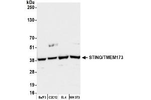 Western Blotting (WB) image for anti-Transmembrane Protein 173 (TMEM173) (AA 329-379) antibody (ABIN7449665)