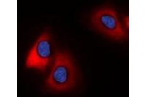 Immunofluorescent analysis of 42431 staining in HeLa cells.