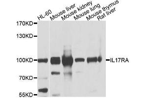 Western blot analysis of extracts of various cell lines, using IL17RA antibody. (IL17RA Antikörper  (AA 697-866))