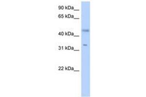 SDR16C5 Antikörper  (AA 179-228)