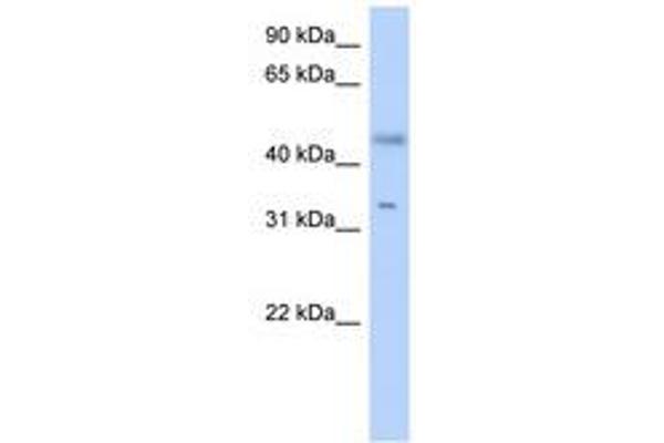 SDR16C5 Antikörper  (AA 179-228)