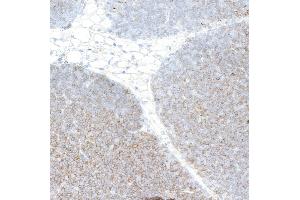 Immunohistochemistry (IHC) image for anti-CD4 (CD4) (AA 407-457) antibody (ABIN7453902) (Rekombinanter CD4 Antikörper  (AA 407-457))