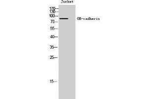 Western Blotting (WB) image for anti-Cadherin 11 (CDH11) (Internal Region) antibody (ABIN3176434) (OB Cadherin Antikörper  (Internal Region))