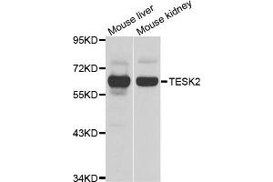 Western blot analysis of extracts of mouse liver and mouse kidney cell lines, using TESK2 antibody. (TESK2 Antikörper)