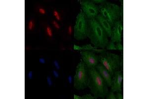 ABIN6261595 and ABIN6276640 staining  cells by IF/ICC. (ERG Antikörper  (C-Term))
