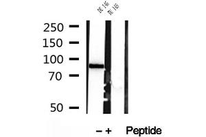 Western blot analysis of extracts of DU 145 cells, using PLOD2-Specific antibody. (PLOD2 Antikörper  (C-Term))
