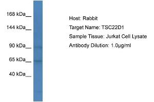 Host: Rabbit Target Name: TSC22D1 Sample Type: Jurkat Whole cell lysates Antibody Dilution: 1.