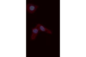 ABIN6276779 staining A549 cells by ICC/IF. (s100a4 Antikörper  (C-Term))