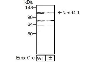 dilution: 1 : 1000, sample: mouse brain homogenate of WT and Nedd4-1f/f;Emx1-Cre± mouse (ECL staining)