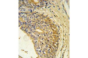 Immunohistochemistry (Paraffin-embedded Sections) (IHC (p)) image for anti-Endothelin Receptor Type B (EDNRB) (AA 409-439), (C-Term) antibody (ABIN390760)