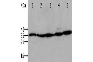 Western Blotting (WB) image for anti-Annexin A5 (ANXA5) antibody (ABIN2420982) (Annexin V Antikörper)