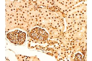 ABIN6267304 at 1/100 staining mouse kidney tissue sections by IHC-P. (C-JUN Antikörper  (pSer243))