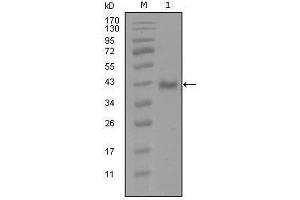 Western Blot showing AR antibody used against truncated Trx-AR recombinant protein (1). (Androgen Receptor Antikörper  (AA 689-919))
