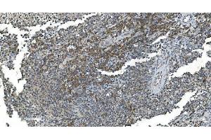 IHC analysis of TIMM8A/DDP using anti-TIMM8A/DDP antibody (ABIN7600039). (TIMM8A/DDP Antikörper  (AA 14-97))