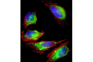 Immunofluorescence (IF) image for anti-Fibroblast Growth Factor Receptor 2 (FGFR2) (AA 22-51), (N-Term) antibody (ABIN391965)