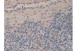 Immunohistochemistry (IHC) image for anti-CD90 (THY1) (AA 20-133) antibody (ABIN7437497)