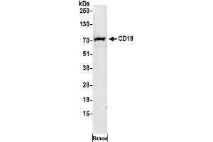Western Blotting (WB) image for anti-CD19 Molecule (CD19) (AA 506-556) antibody (ABIN7453054)