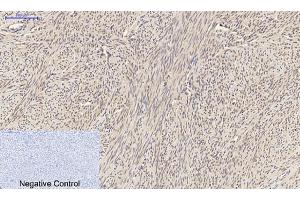 Immunohistochemical analysis of paraffin-embedded human uterus tissue. (SMAD2 Antikörper)