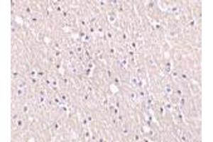 Immunohistochemistry of CIDE-A in human brain tissue with CIDE-A antibody at 5 μg/ml. (CIDEA Antikörper  (C-Term))