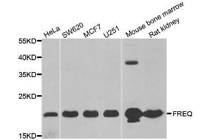 Western blot analysis of extracts of various cell lines, using NCS1 antibody. (NCS1 Antikörper  (AA 1-190))