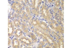 Immunohistochemistry of paraffin-embedded Rat kidney using IL12RB1 Polyclonal Antibody at dilution of 1:200 (40x lens). (IL12RB1 Antikörper)