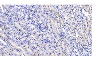 Detection of ABP1 in Mouse Kidney Tissue using Polyclonal Antibody to Amiloride Binding Protein 1 (ABP1) (DAO Antikörper  (AA 292-460))
