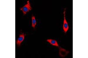 Immunofluorescent analysis of ROCK1 staining in NIH3T3 cells. (ROCK1 Antikörper  (Center))