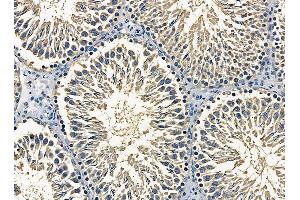 ABIN7095344 and ABIN7099401 at 1/100 staining rat testis tissue by IHC-P.